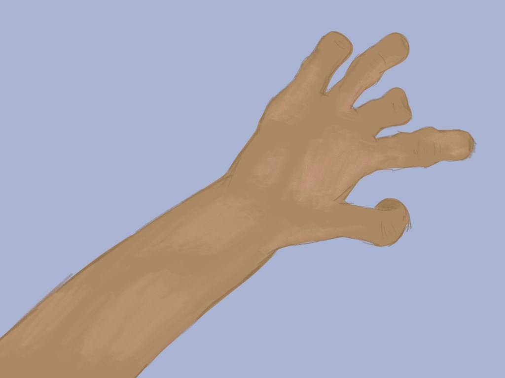 Historical “Curse” No Longer: On Leprosy (Hansen’s&nbsp;Disease)